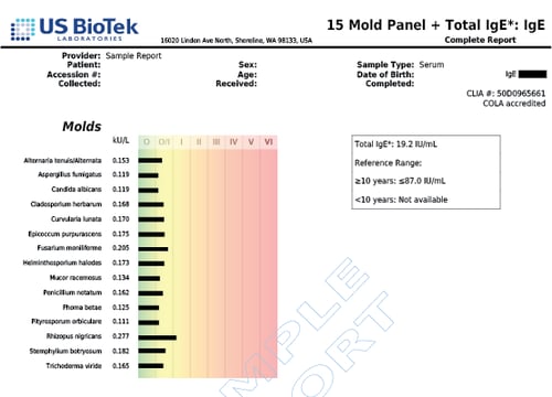 15 Mold Panel + Total IgE