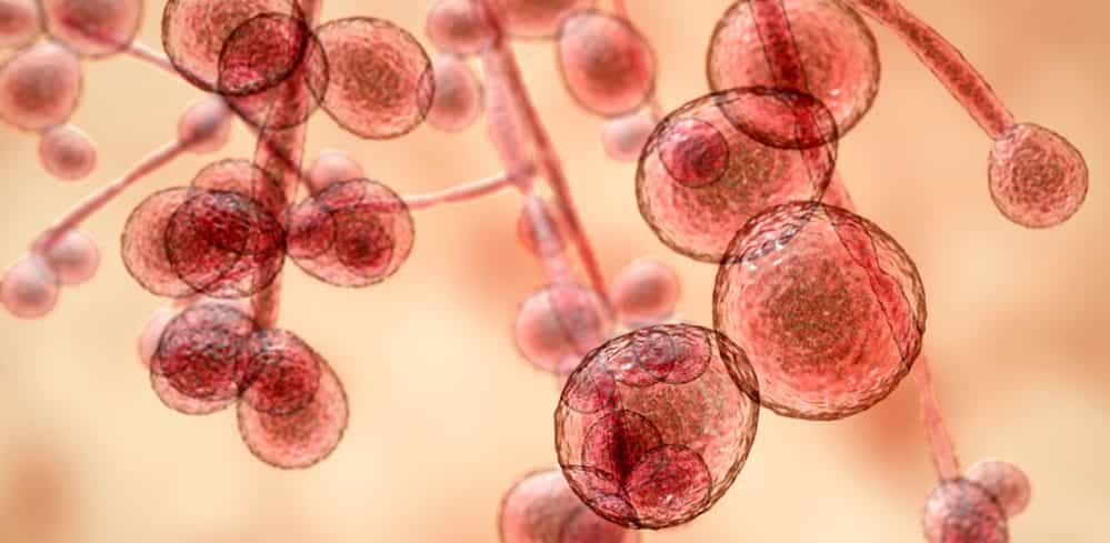 4 Things Clinicians Need to Know About Candida Immunoglobulin (Ig) Screening