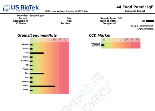 44 IgE Food Panel 2