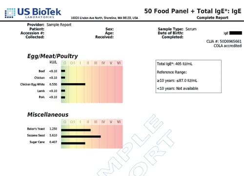 50 Food Panel + Total IgE 2