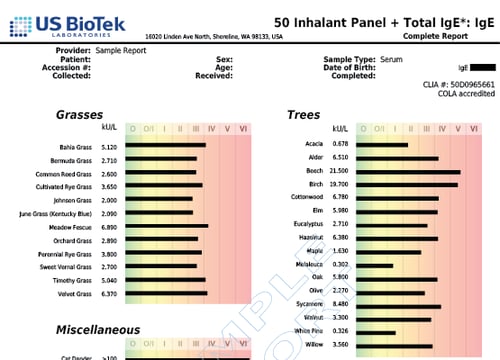 50 Inhalant Panel + Total IgE