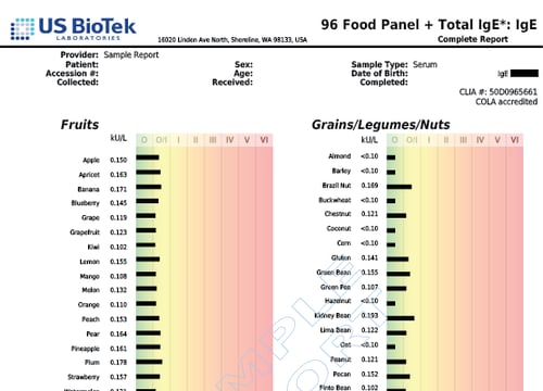 96 Food Panel + Total IgE 2