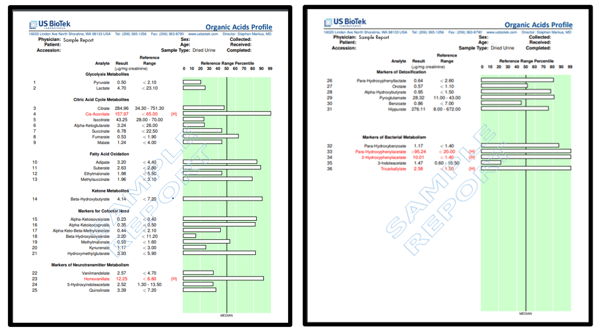 Organic Acids Test Report