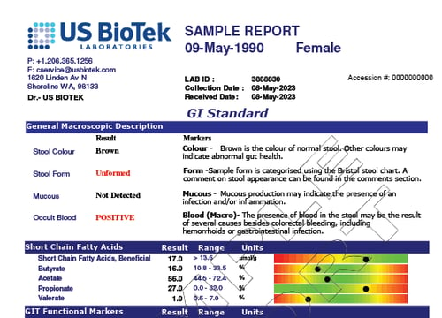 GI - Standard Profile 1