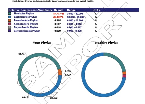 GI - Standard Profile 2