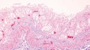 Fecal Short Chain Fatty Acids