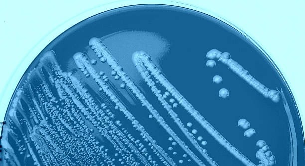 Microbiome culture used to help identify SIBO and determine diagnostics