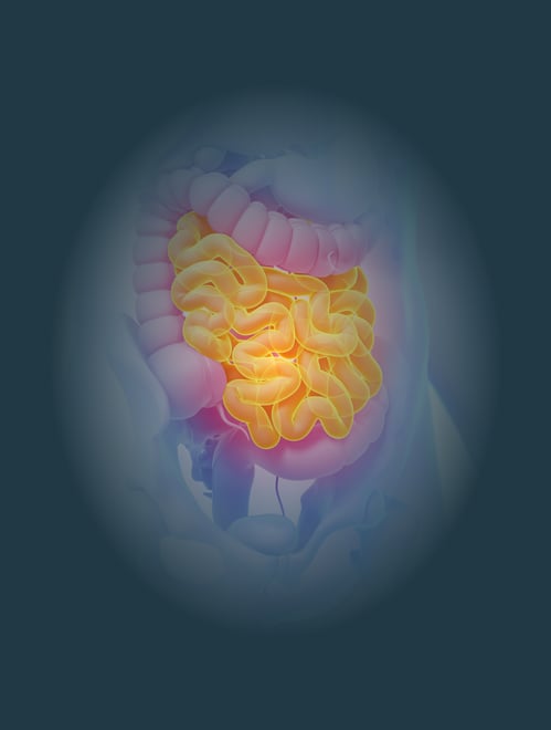 Inflamed gut from Bacterial Overgrowth