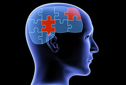 A depiction of an x-ray image of someones mind and how puzzling it can be.