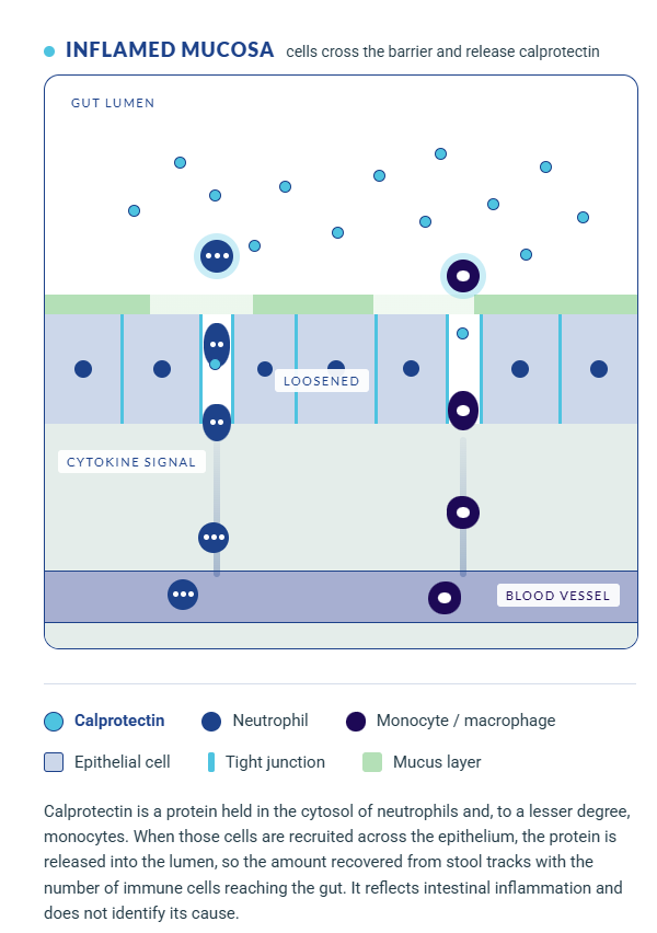 Calprotectin Diagram-selection