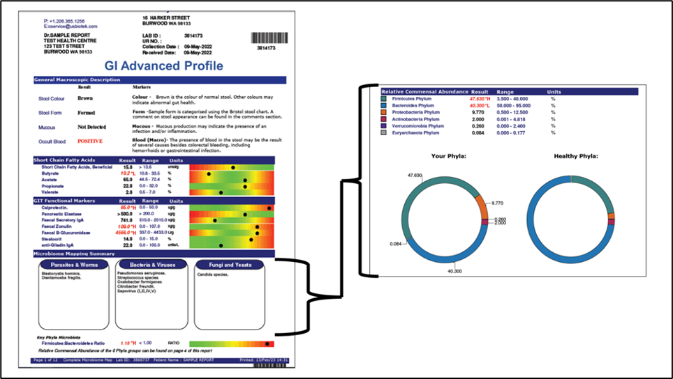 Cardiovasular Risk Through Stool Testing