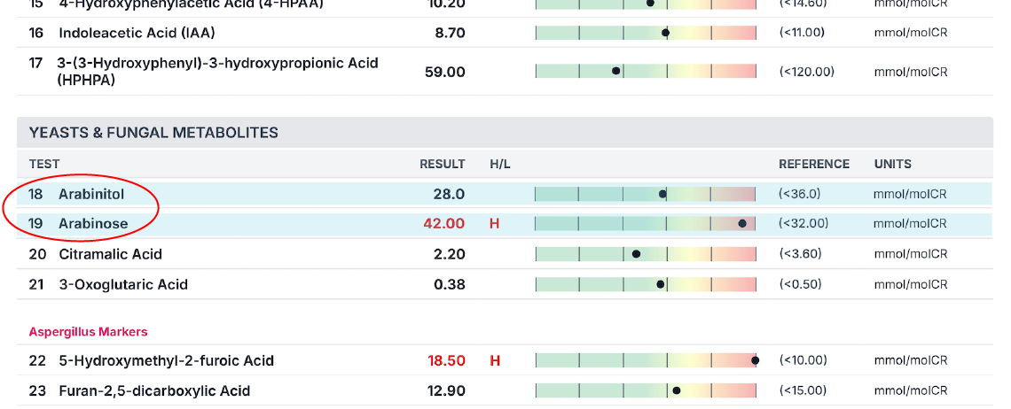 sample report - organic acids profile