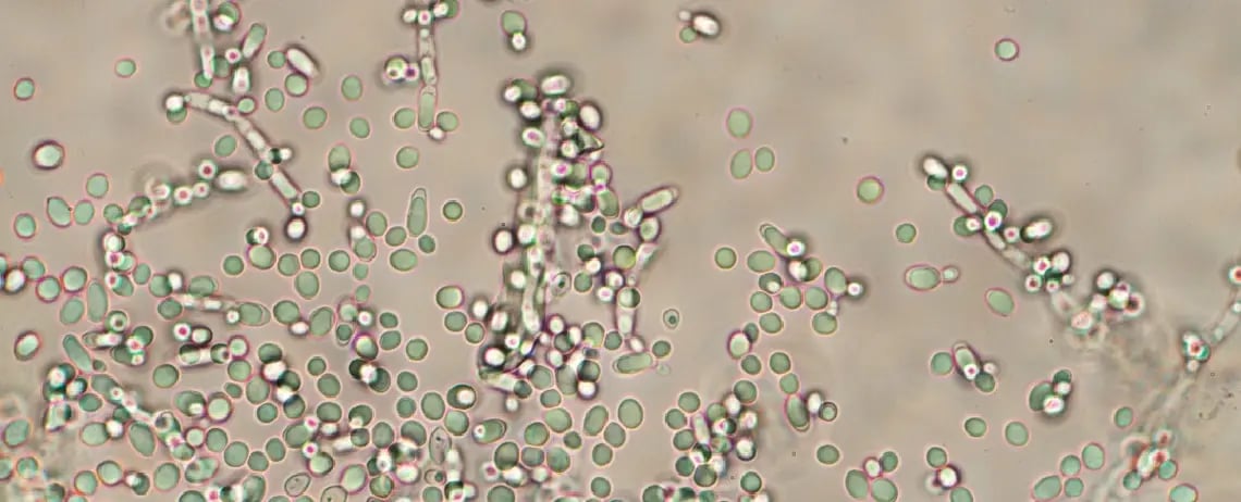 yeast under microscope