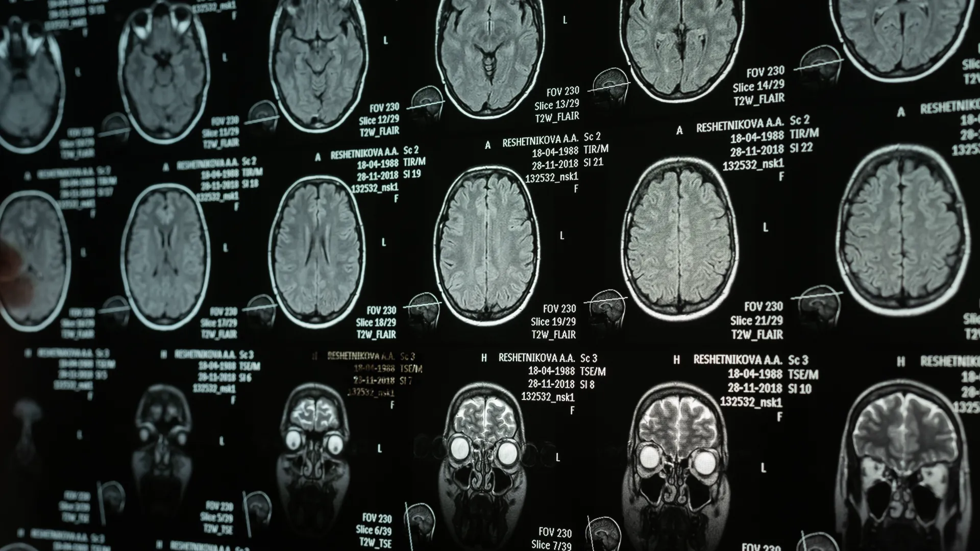 Images of brain scans