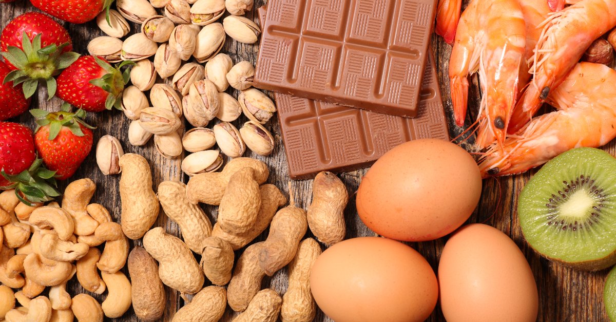 Food Allergy Testing