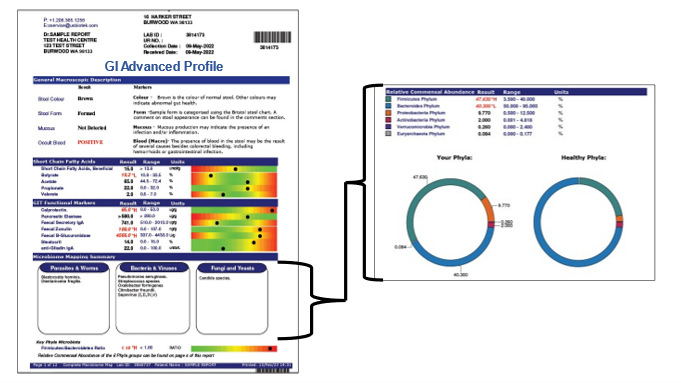 A sample of GI Advanced Profile and Markers